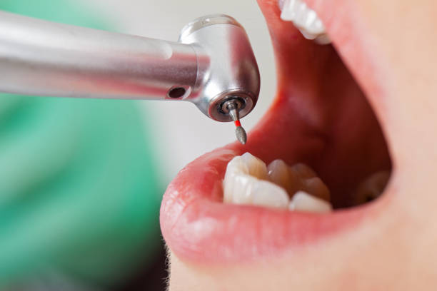 Best Pediatric Emergency Dentist in Lake Morton Berrydale, WA